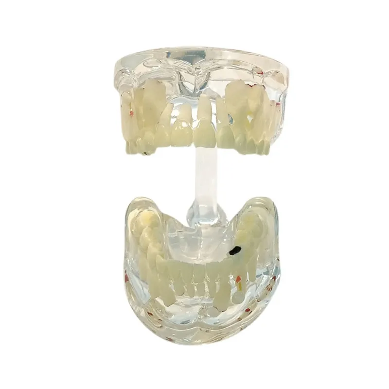 Стоматологическая Педиатрическая патология Демонстрационная модель детских зубов Смола M4002 для обучения стоматологии Typodont Инструменты для обучения стоматологии
