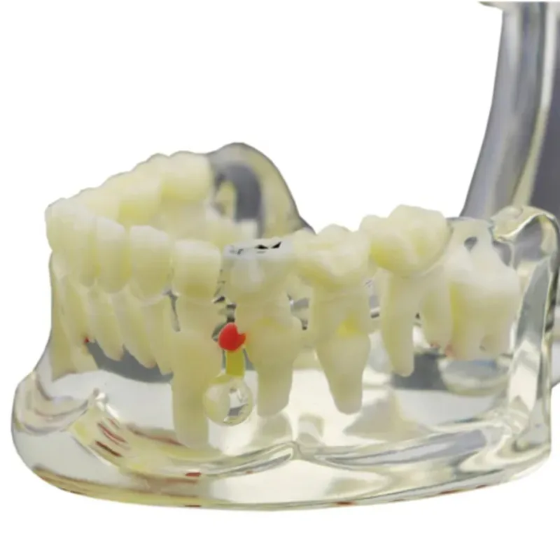 Стоматологическая Педиатрическая патология Демонстрационная модель детских зубов Смола M4002 для обучения стоматологии Typodont Инструменты для обучения стоматологии